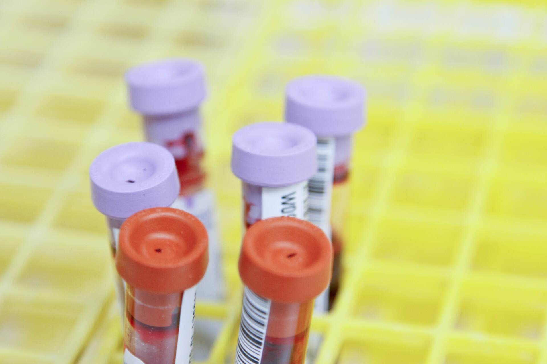 AAEM: Ученые раскрыли секрет, какую группу крови предпочитают клещи